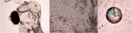 Fish hatchling otoliths in the larval head (left and centre close up) and extracted (right). The diameter of the otolith is ~ 25 microns.